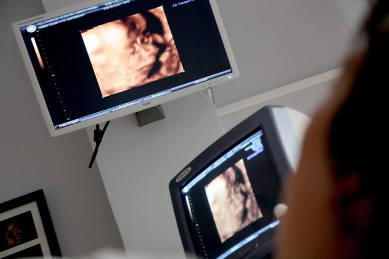 display, ultrasound, medical consultation, diagnosis, consultation, consulting room, ultrasound, ultrasound, ultrasound, ultrasound, ultrasound